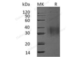 Recombinant Mouse Interleukin-9/IL-9 Protein (His Tag)