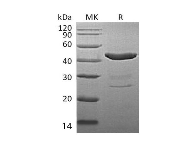 Recombinant Mouse IDO1/IDO Protein (His Tag)