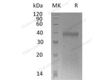 Recombinant Mouse IGFBP-5/IGFBP5 Protein (His Tag)