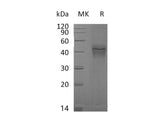 Recombinant Mouse IFNGR1 Protein (His Tag)