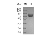 Recombinant Mouse IFNGR1 Protein (Fc Tag)