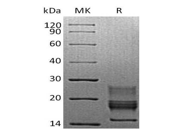 Recombinant Mouse Interferon γ/IFNG Protein (His Tag)