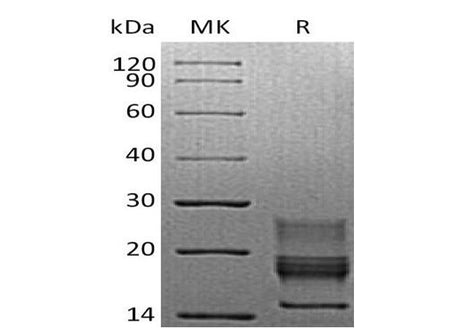 Recombinant Mouse Interferon γ/IFNG Protein (His Tag)