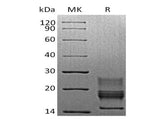 Recombinant Mouse Interferon γ/IFNG Protein (His Tag)