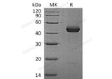 Recombinant Mouse IL-12 p40/IL-12B Protein (His Tag)