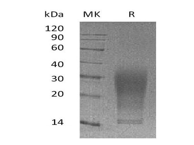 Recombinant Mouse Interleukin-13/IL-13 Protein (aa 22-131,His Tag)(Active)