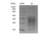 Recombinant Mouse Interleukin-13/IL-13 Protein (aa 22-131,His Tag)(Active)
