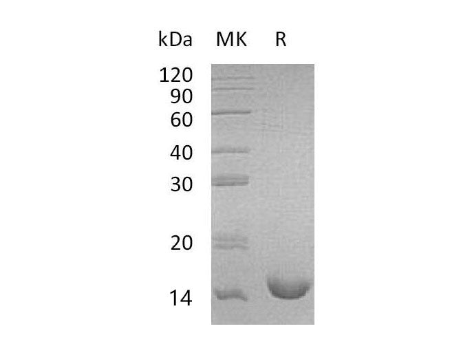 Recombinant Mouse Interleukin-16/IL-16 Protein (His Tag)