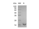 Recombinant Mouse Interleukin-16/IL-16 Protein (His Tag)