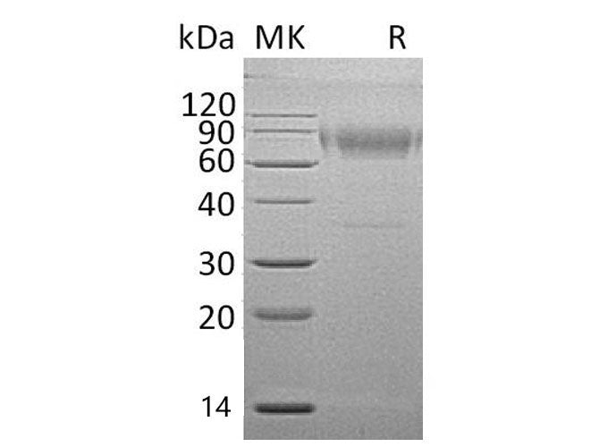 Recombinant Mouse IL18BP Protein (Fc Tag)