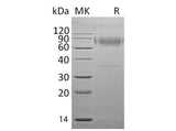 Recombinant Mouse IL18BP Protein (Fc Tag)