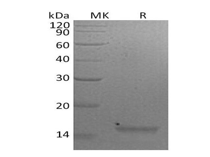 Recombinant Mouse Interleukin-21/IL-21 Protein