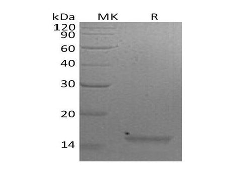 Recombinant Mouse Interleukin-21/IL-21 Protein