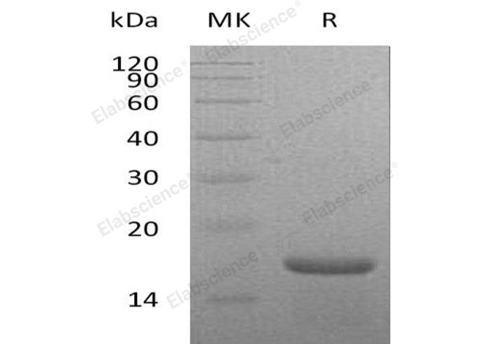 Recombinant Mouse Interleukin-21/IL-21 Protein (His Tag)