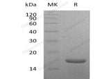 Recombinant Mouse Interleukin-21/IL-21 Protein (His Tag)
