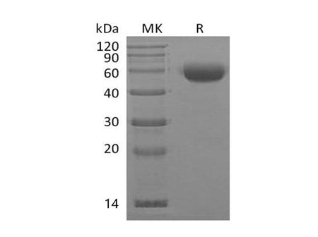 Recombinant Mouse Interleukin-22/IL-22 Protein (mFc Tag) 