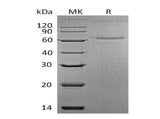 Recombinant Mouse Interleukin-27/IL-27 Protein (His Tag)