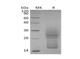 Recombinant Mouse Interleukin-3/IL-3 Protein (His Tag)
