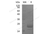 Recombinant Mouse Interleukin-4/IL-4 Protein (His Tag)