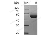 Recombinant Mouse IL-5RA/IL-5 Rα Protein (Human Cells, His Tag) (Active)
