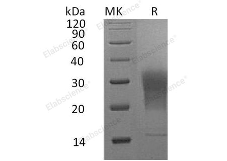 Recombinant Mouse LAIR1 Protein (aa 22-141, His Tag)
