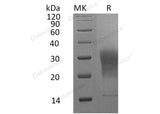 Recombinant Mouse LAIR1 Protein (aa 22-141, His Tag)