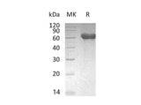 Recombinant Mouse CD300a/LMIR1 Protein (Fc Tag)