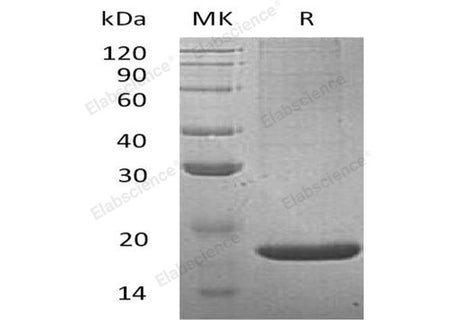 Recombinant Mouse Lithostathine-2/REG2 Protein (His Tag)
