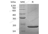 Recombinant Mouse Lithostathine-2/REG2 Protein (His Tag)