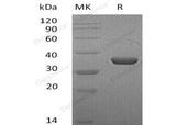 Recombinant Mouse LDHA/LDH1 Protein (His Tag)