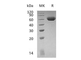 Recombinant Mouse LAG3 Protein (His Tag)(Active)