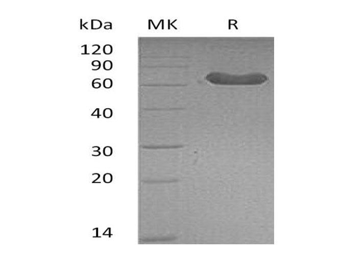 Recombinant Mouse LTBR/TNFRSF3 Protein (Fc Tag)