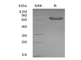 Recombinant Mouse LTBR/TNFRSF3 Protein (Fc Tag)