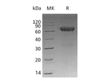 Recombinant Mouse MMP12/MMP-12/HME Protein (His Tag)