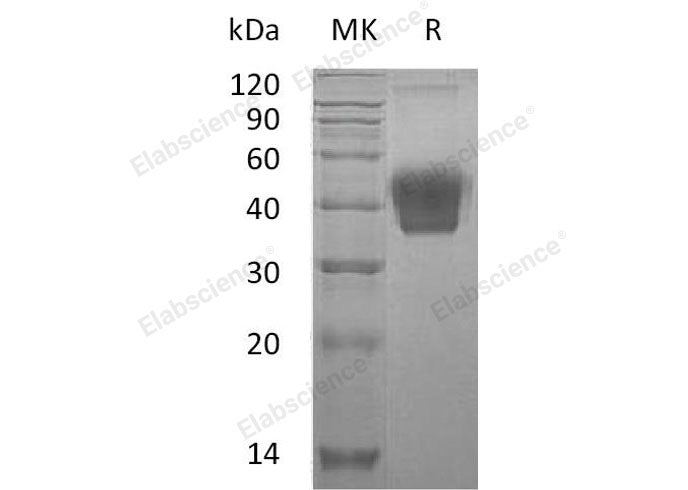 Recombinant Mouse M-CSF/CSF1 Protein (His Tag)