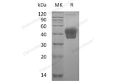 Recombinant Mouse M-CSF/CSF1 Protein (His Tag)