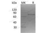 Recombinant Mouse NCR1 Protein (His Tag)