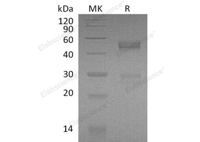 Recombinant Mouse NOV/CCN3 Protein (His Tag) 