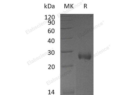 Recombinant Mouse NBL1/DAND1 Protein (His Tag)