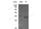 Recombinant Mouse NBL1/DAND1 Protein (His Tag)