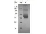 Recombinant Mouse NKG2DL/ULBP-1 Protein (His Tag)