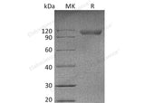 Recombinant Mouse NgR/RTN4R Protein (Fc Tag)