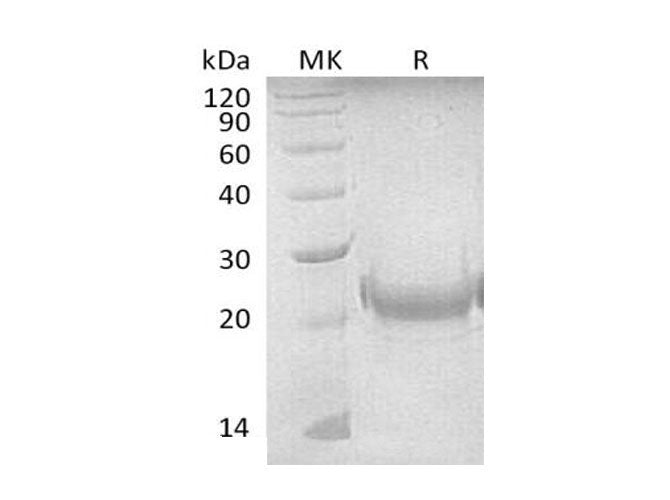 Recombinant Mouse TNFSF4/OX40L Protein (His Tag)