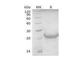 Recombinant Mouse TNFSF4/OX40L Protein (His Tag)