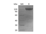 Recombinant Mouse PDGFRa/CD140a Protein (Fc Tag)