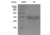 Recombinant Mouse PGF/PIGF Protein (His Tag)(Active)