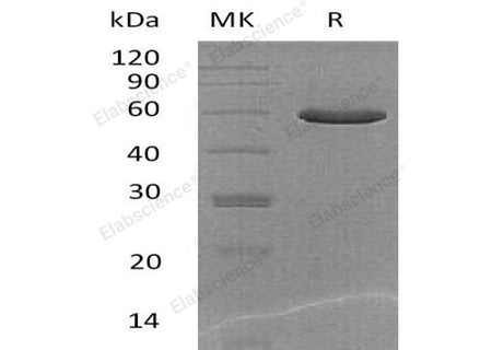 Recombinant Mouse CPQ/PGCP Protein (His Tag)