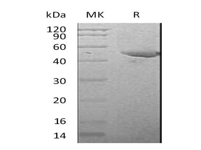 Recombinant Mouse Serpin E1/PAI-1 Protein (His Tag) Purity >95%