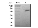 Recombinant Mouse Serpin E1/PAI-1 Protein (His Tag) Purity >95%