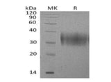 Recombinant Mouse B7-H5/Gi24/VSIR Protein (His Tag)
